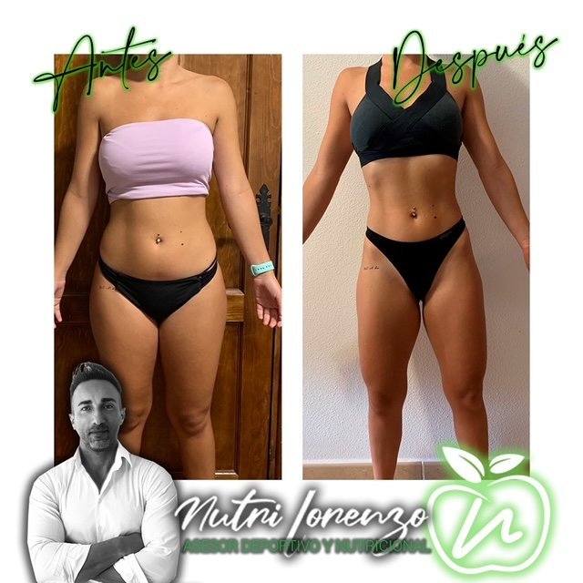 Antes y después de un paciente de Nutri Lorenzo