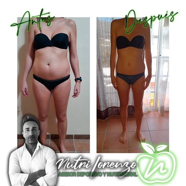 Antes y después de un paciente de Nutri Lorenzo