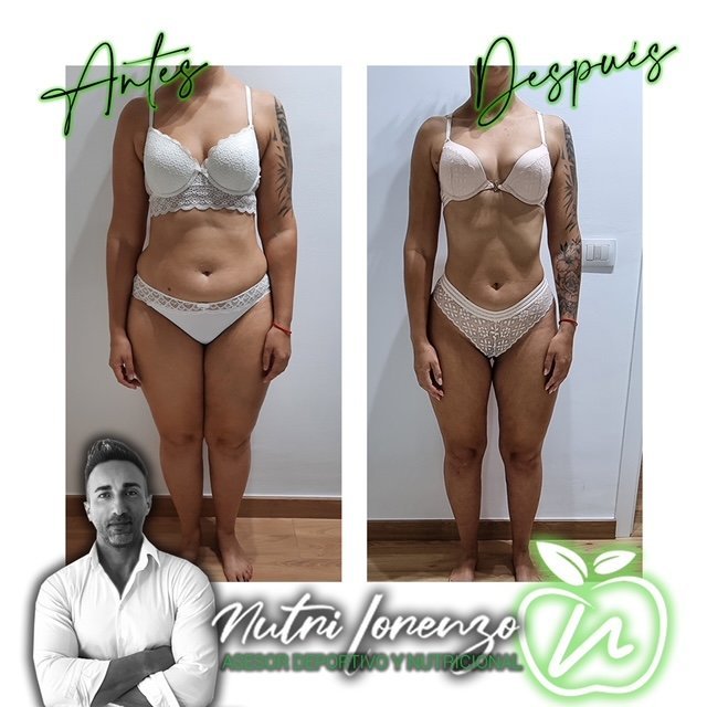 Antes y después de un paciente de Nutri Lorenzo