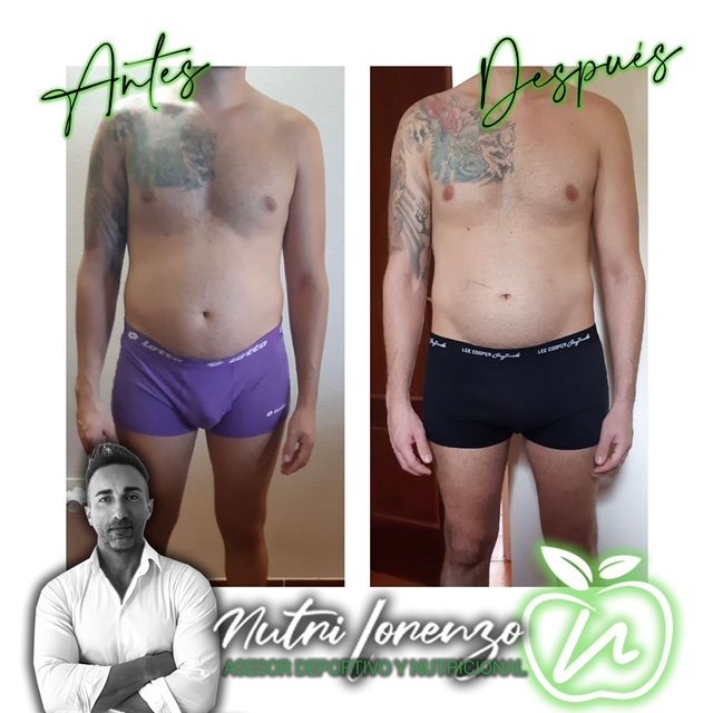 Antes y después de un paciente de Nutri Lorenzo