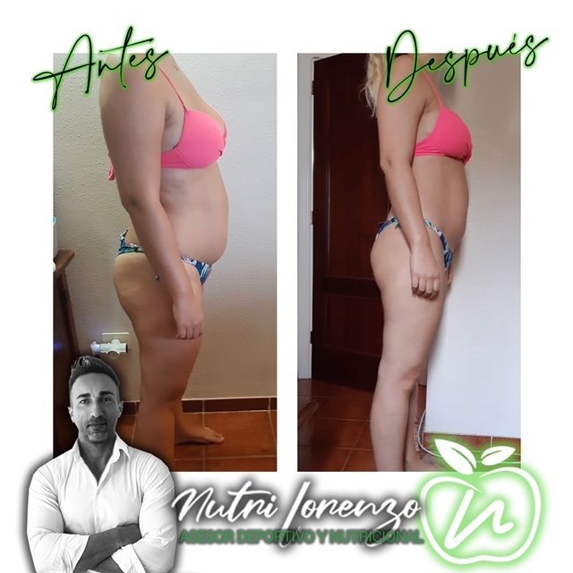 Antes y después de un paciente de Nutri Lorenzo