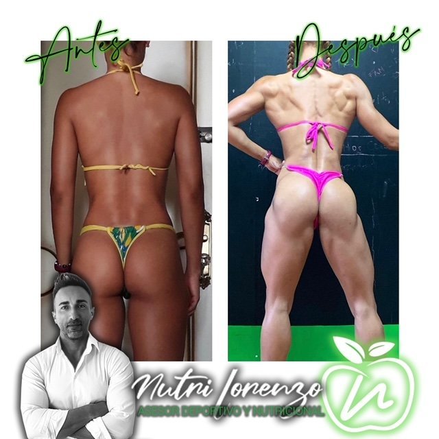 Antes y después de un paciente de Nutri Lorenzo