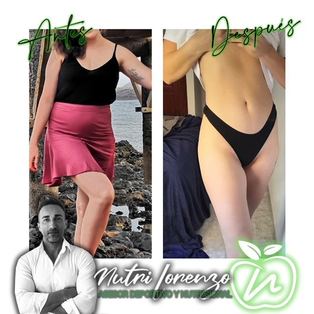 Antes y después de un paciente de Nutri Lorenzo