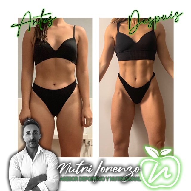 Antes y después de un paciente de Nutri Lorenzo