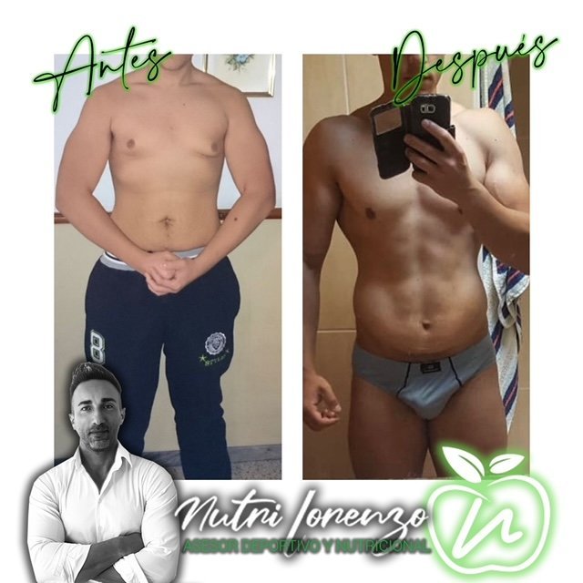 Antes y después de un paciente de Nutri Lorenzo