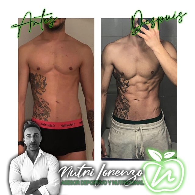 Antes y después de un paciente de Nutri Lorenzo