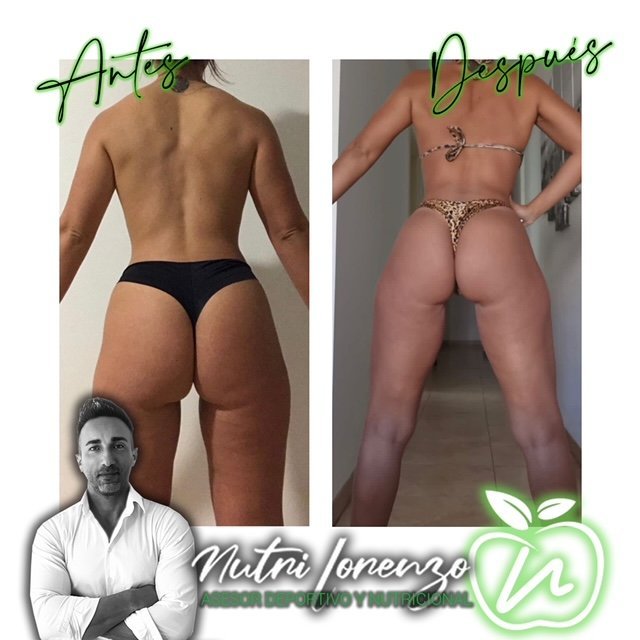 Antes y después de un paciente de Nutri Lorenzo