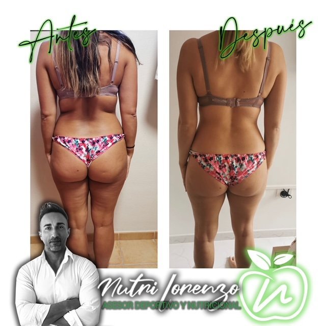 Antes y después de un paciente de Nutri Lorenzo