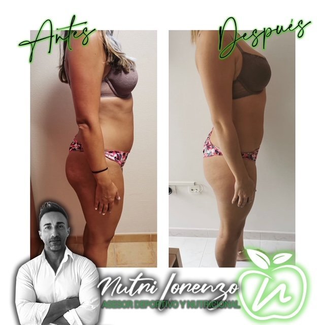 Antes y después de un paciente de Nutri Lorenzo