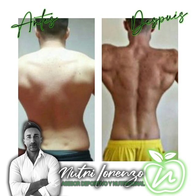 Antes y después de un paciente de Nutri Lorenzo