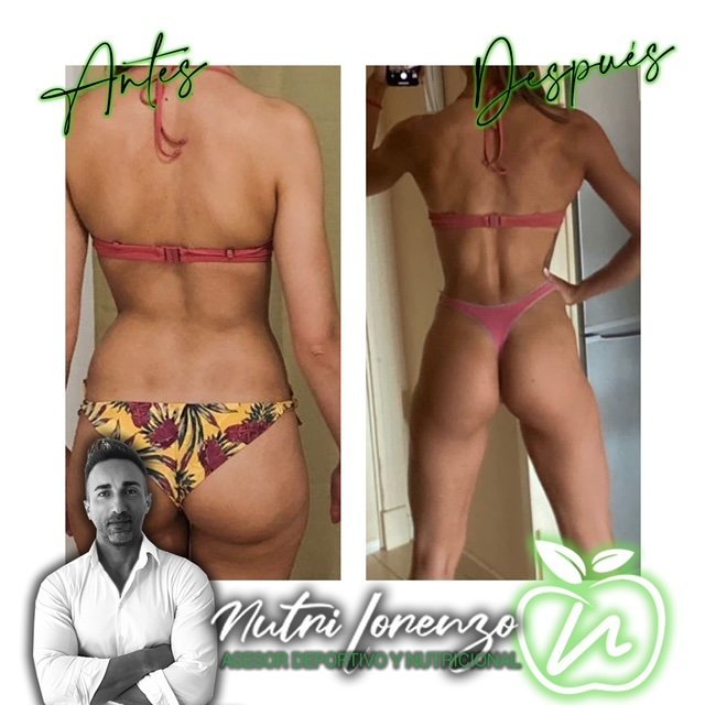 Antes y después de un paciente de Nutri Lorenzo