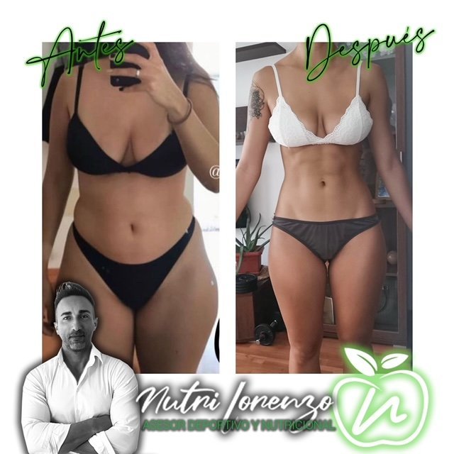 Antes y después de un paciente de Nutri Lorenzo