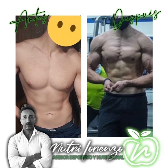 Antes y después de un paciente de Nutri Lorenzo