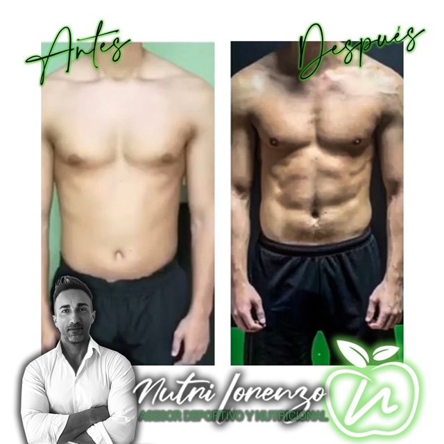 Antes y después de un paciente de Nutri Lorenzo