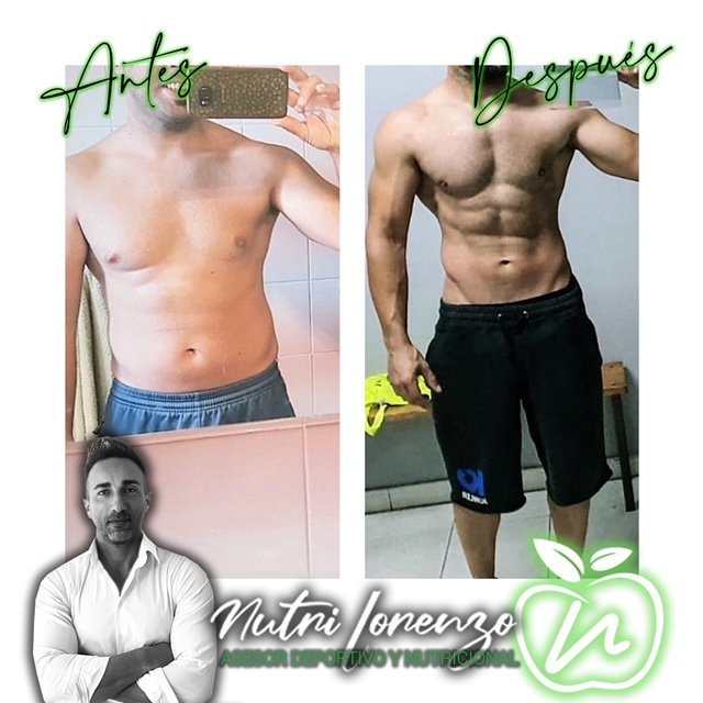 Antes y después de un paciente de Nutri Lorenzo