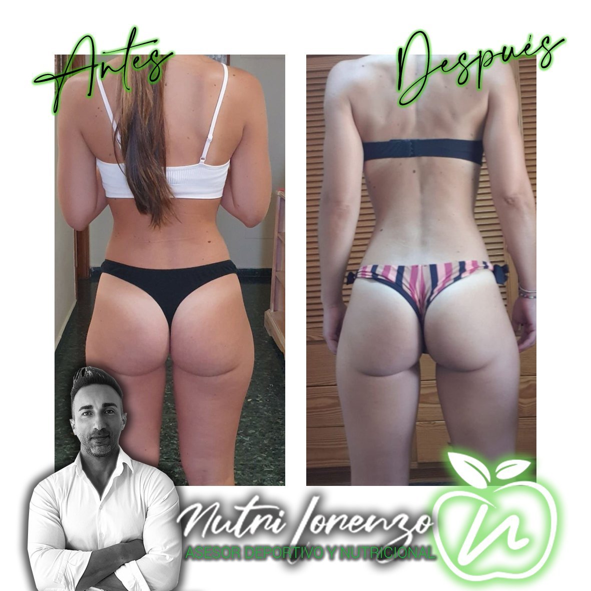 Antes y después de un paciente de Nutri Lorenzo